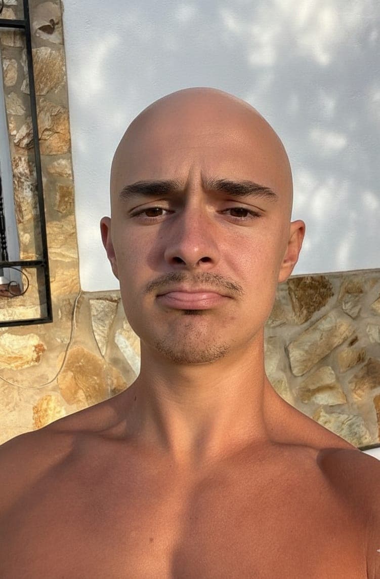 alopecia-caida-del-cabello-salud-capilar